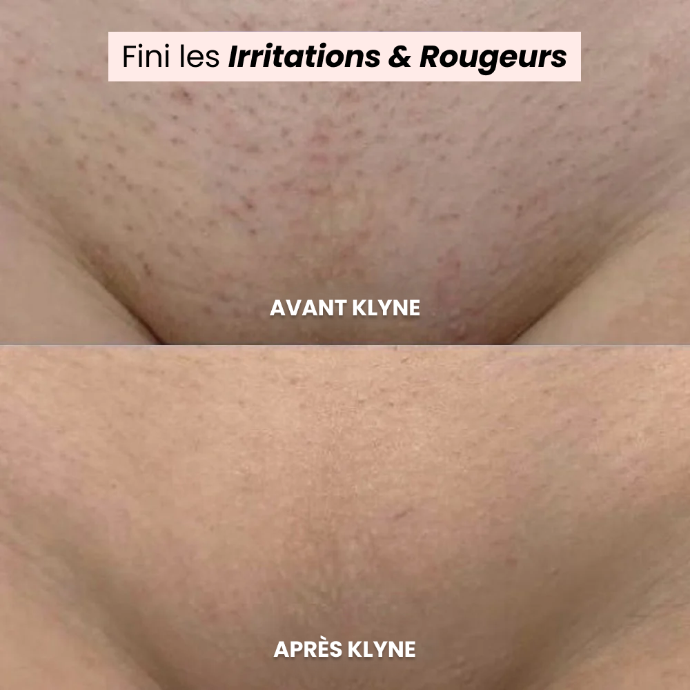 Vue 5 du rasoir KLYNE
