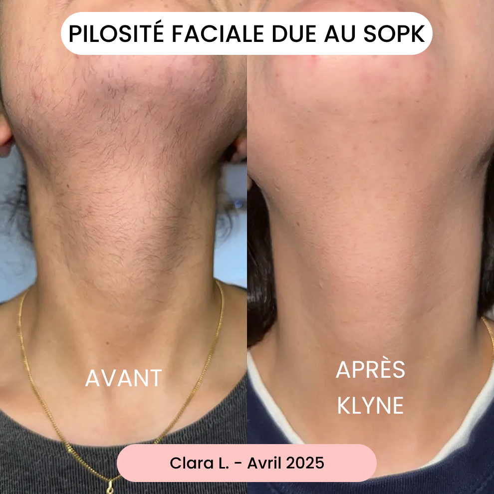 Avis de Clara L.