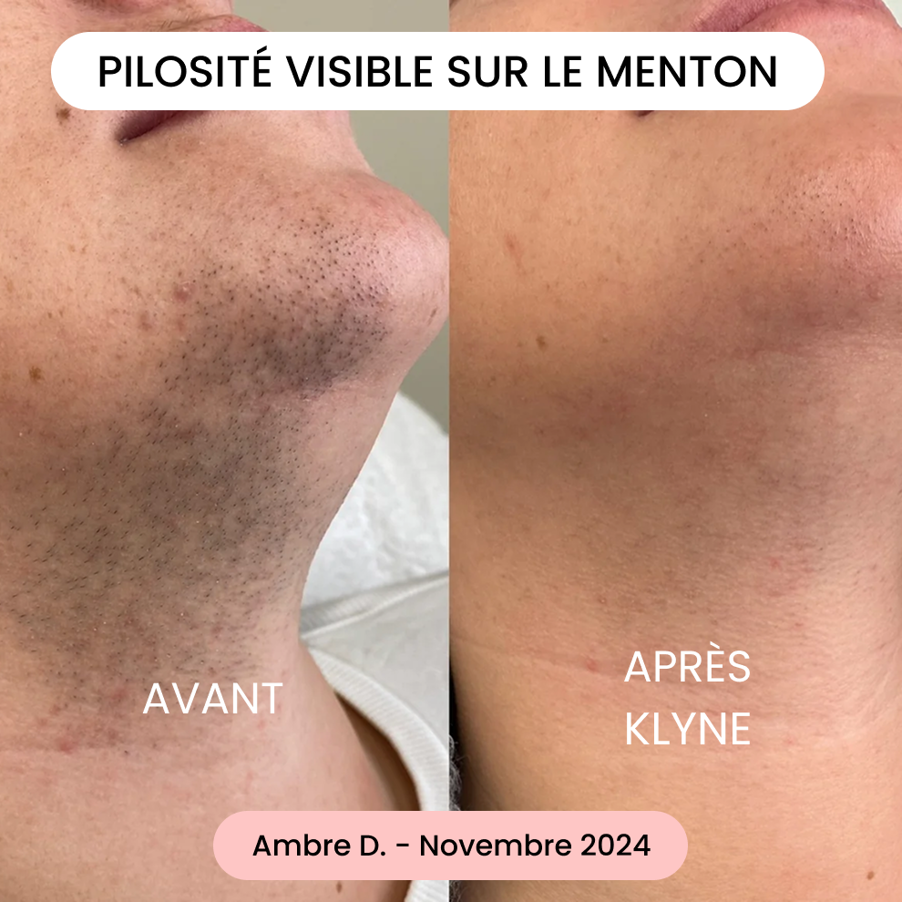Avis de Ambre D.