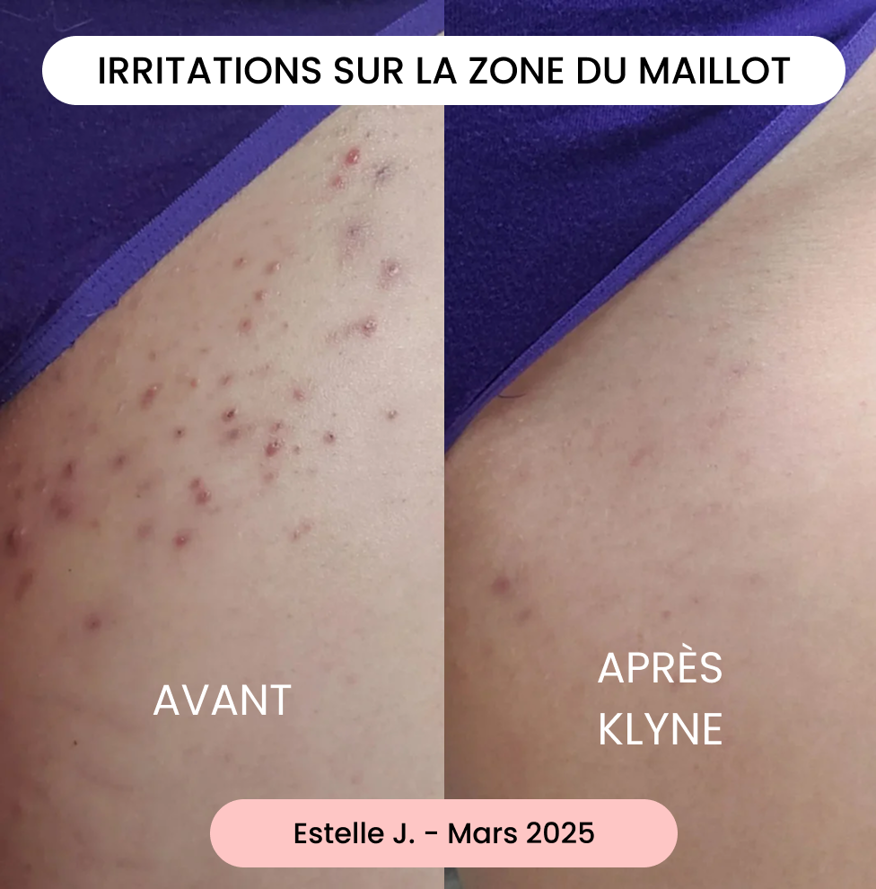 Avis de Estelle J.