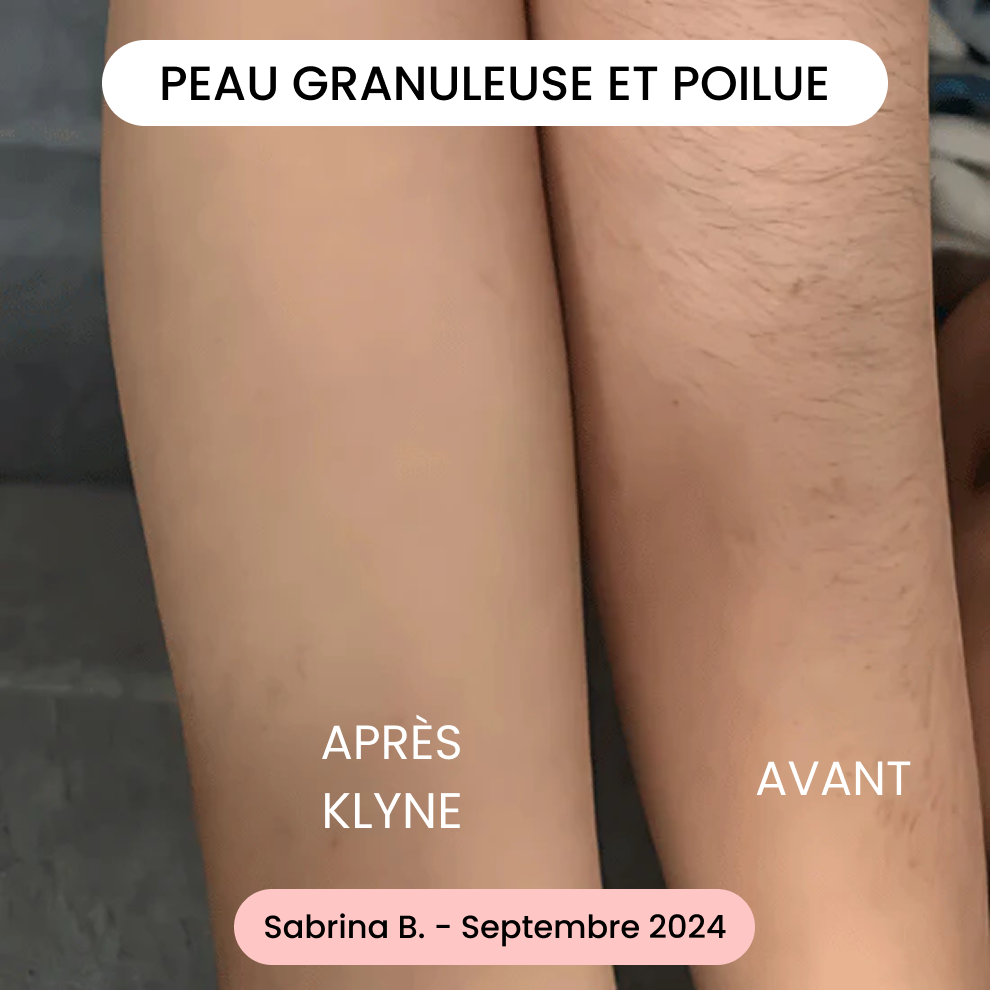 Avis de Sabrina B.