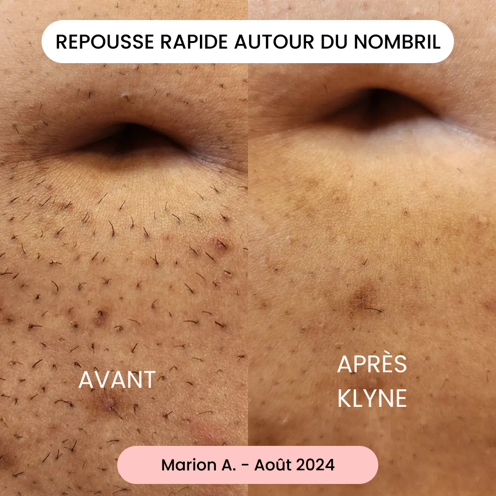 Avis de Marion A.